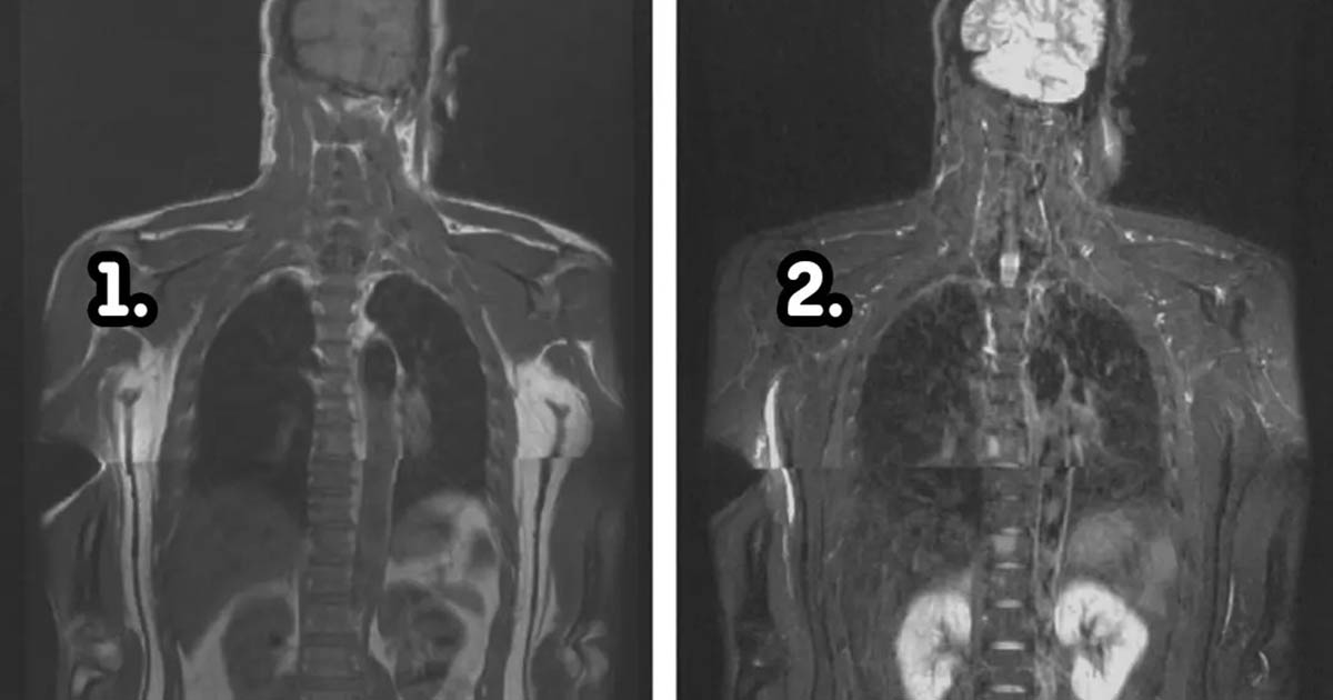 Milyen változások mennek végbe a testben a halál után? 15 elképesztő folyamat