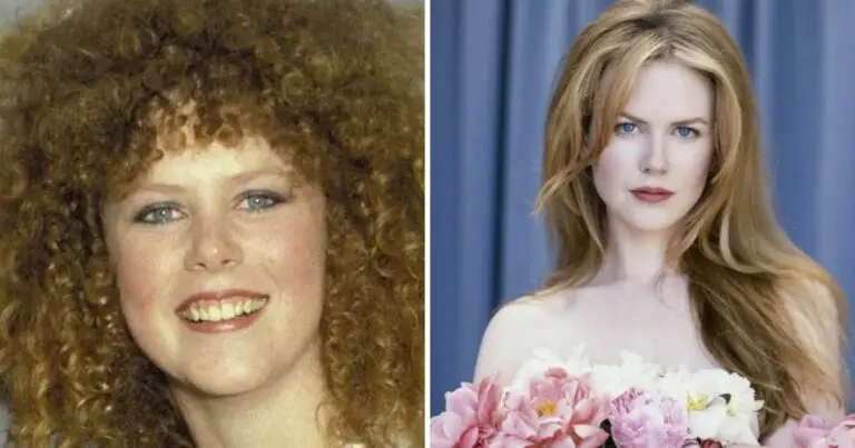 7 hollywoodi sztár, akiknek a külsejét plasztikai műtétek változtatták meg